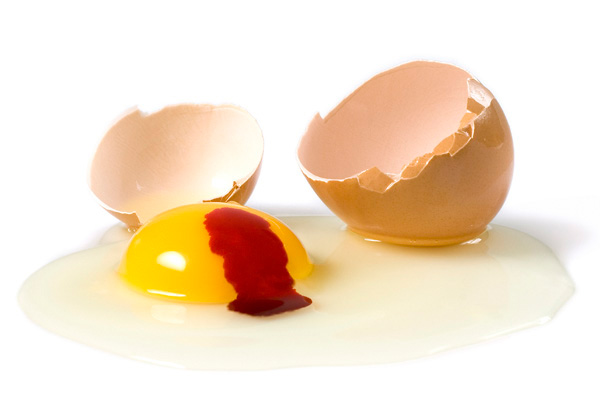 Thinkstock