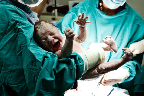 Thinkstock Thinkstock